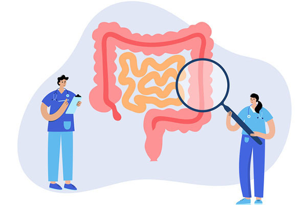 You are currently viewing Colon cancer screening decisions: What’s the best option and when?